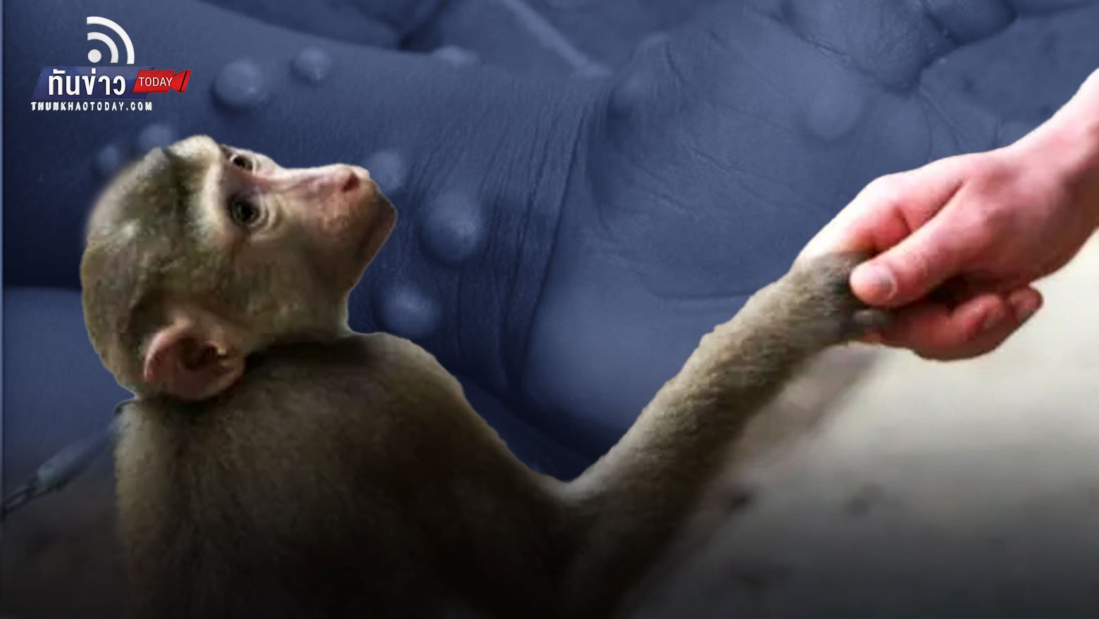 กรมควบคุมโรคเตือนระวัง “โรคฝีดาษลิง” ติดจากสัตว์สู่คน แนะวิธีป้องกัน